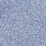 TULP3 Polyclonal Antibody