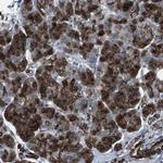 FAM174B Antibody in Immunohistochemistry (Paraffin) (IHC (P))