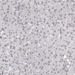ZNF532 Antibody in Immunohistochemistry (Paraffin) (IHC (P))