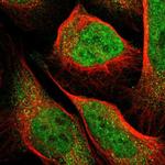 PCTAIRE2 Polyclonal Antibody