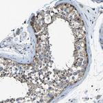 PCTAIRE2 Antibody in Immunohistochemistry (IHC)
