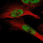 ZBTB11 Polyclonal Antibody