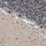ZBTB11 Antibody in Immunohistochemistry (Paraffin) (IHC (P))