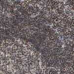 ZBTB11 Antibody in Immunohistochemistry (Paraffin) (IHC (P))