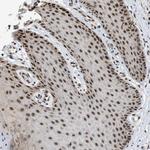 ZBTB11 Antibody in Immunohistochemistry (Paraffin) (IHC (P))