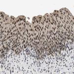 ZBTB11 Antibody in Immunohistochemistry (Paraffin) (IHC (P))