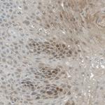 SERPINB2 Antibody in Immunohistochemistry (Paraffin) (IHC (P))