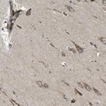 B3GNT1 Polyclonal Antibody