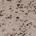 IL1RL2 Polyclonal Antibody