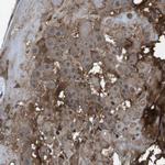 CDH20 Polyclonal Antibody