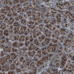 TMEM115 Polyclonal Antibody