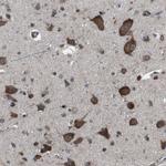 GDF10 Antibody in Immunohistochemistry (Paraffin) (IHC (P))