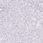 EQTN Antibody in Immunohistochemistry (IHC)