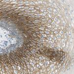 SMYD5 Antibody in Immunohistochemistry (Paraffin) (IHC (P))