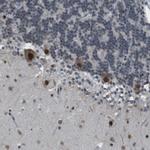 SRPK2 Antibody in Immunohistochemistry (Paraffin) (IHC (P))