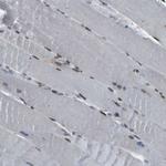 SRPK2 Antibody in Immunohistochemistry (Paraffin) (IHC (P))