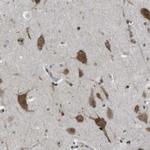 SRPK2 Antibody in Immunohistochemistry (IHC)