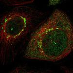 LRIG2 Polyclonal Antibody