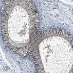 LRIG2 Antibody in Immunohistochemistry (IHC)