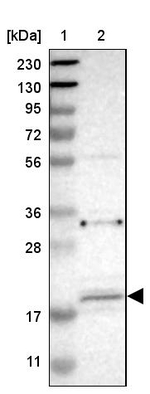 JWA Antibody in Western Blot (WB)