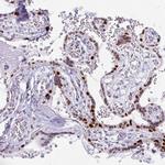 MORC4 Antibody in Immunohistochemistry (Paraffin) (IHC (P))