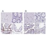 MORC4 Antibody in Immunohistochemistry (IHC)