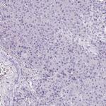 MORC4 Antibody in Immunohistochemistry (IHC)