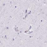 MORC4 Antibody in Immunohistochemistry (IHC)