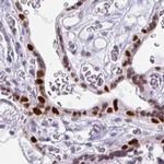 MORC4 Antibody in Immunohistochemistry (IHC)