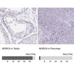 MORC4 Antibody
