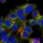 WNK2 Polyclonal Antibody