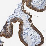 Unc18-2 Antibody in Immunohistochemistry (Paraffin) (IHC (P))