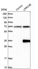 LRP15 Antibody in Western Blot (WB)