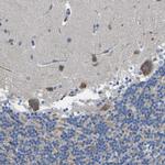 TMEFF2 Antibody in Immunohistochemistry (Paraffin) (IHC (P))