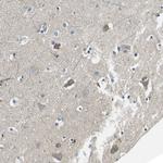 TMEFF2 Polyclonal Antibody