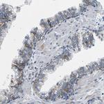 TMEFF2 Antibody in Immunohistochemistry (Paraffin) (IHC (P))