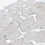 TMEFF2 Antibody in Immunohistochemistry (Paraffin) (IHC (P))