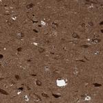 ITFG1 Polyclonal Antibody