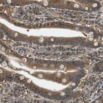 TBC1D15 Antibody in Immunohistochemistry (Paraffin) (IHC (P))