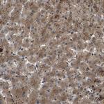 TBC1D15 Antibody in Immunohistochemistry (Paraffin) (IHC (P))