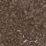 TBC1D15 Polyclonal Antibody