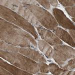 TBC1D15 Antibody in Immunohistochemistry (Paraffin) (IHC (P))