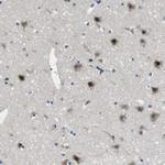 LRRC49 Polyclonal Antibody