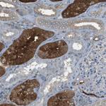 PEPD Antibody in Immunohistochemistry (Paraffin) (IHC (P))