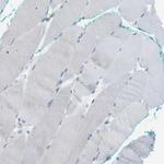 PEPD Antibody in Immunohistochemistry (Paraffin) (IHC (P))