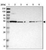 PEPD Antibody in Western Blot (WB)