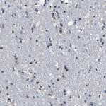 SNX10 Antibody in Immunohistochemistry (IHC)