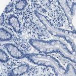 TMPRSS15 Antibody in Immunohistochemistry (IHC)