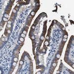 TMPRSS15 Antibody in Immunohistochemistry (IHC)