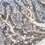 SCNN1B Polyclonal Antibody